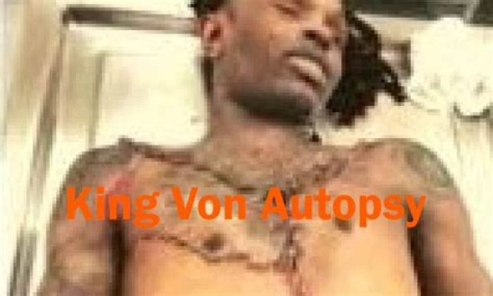 King Von Autopsy Photo: Unveiling The Truth Behind The Controversy