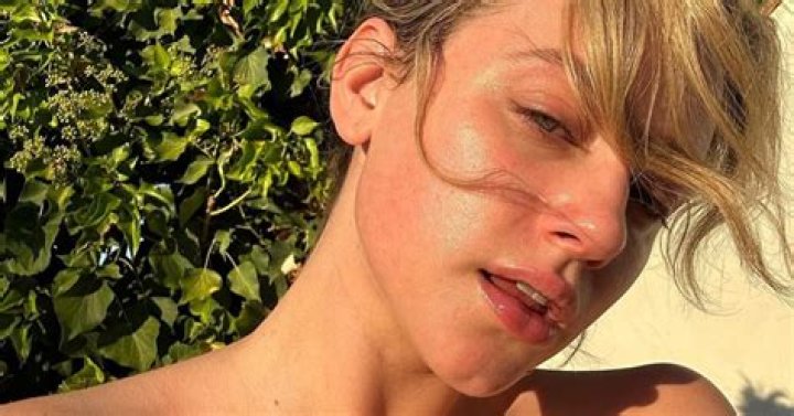 Lili Reinhart Gets Candid About Acne Struggles in Topless Photo