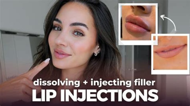 Lindsay Lohan Denies Getting Lip Injections