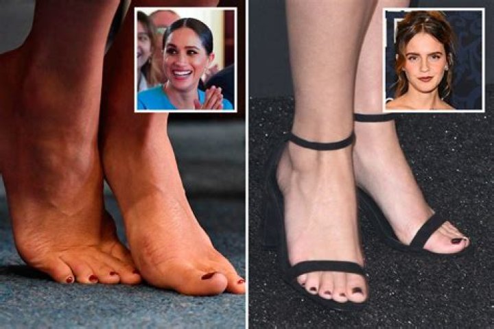 Who has the most beautiful feet in the world? According to the golden ratio