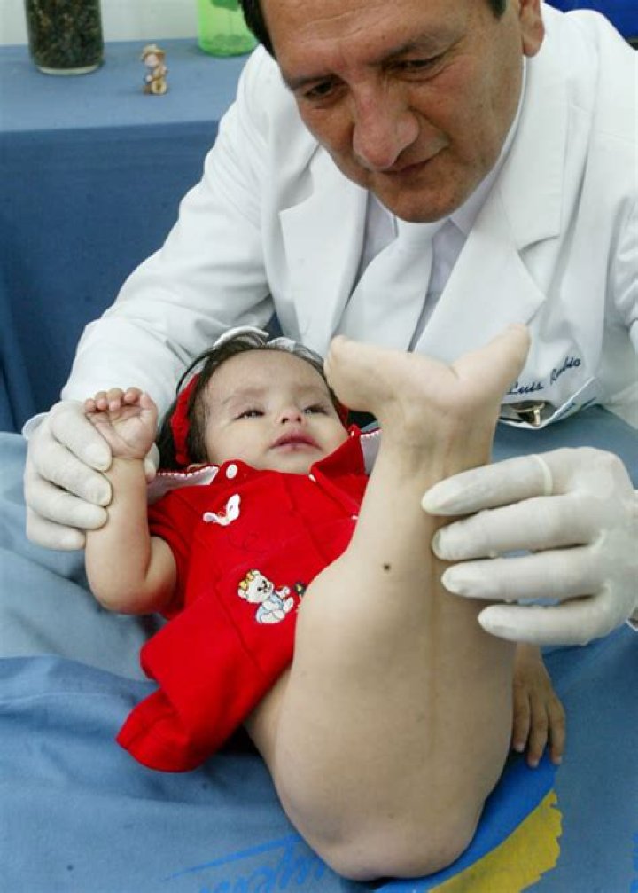 “Mermaid Girl” Shiloh Pepin was born with mystery disease – defied doctors’ odds for 10 years