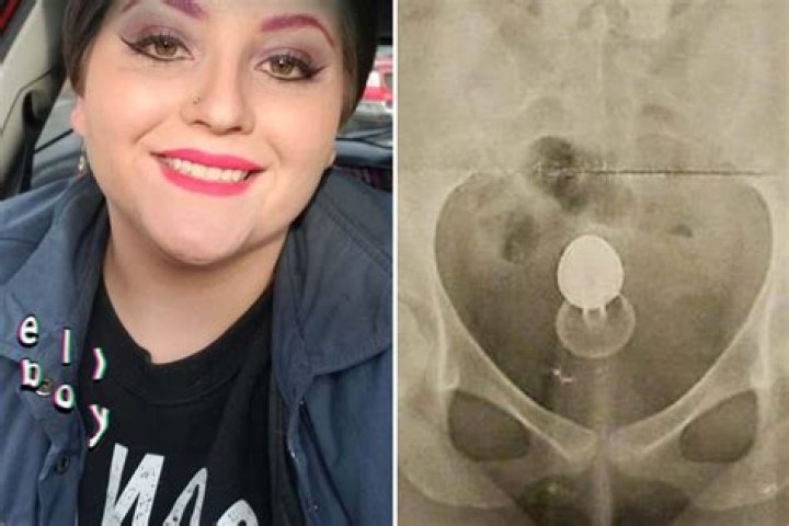 Mortified woman ends up in A&E after accident with a sex toy - and her story is VERY detailed