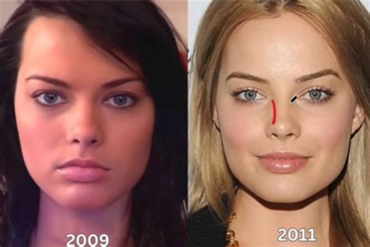 Nicole Richie and Kate Hudson Share the Same Plastic Surgeon!