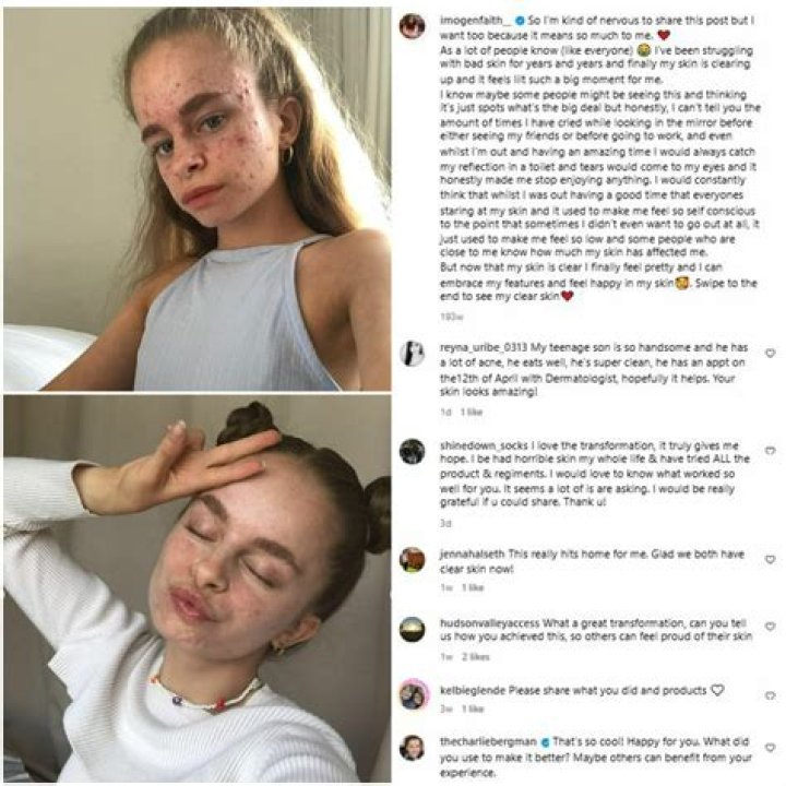 Phelix Imogen Fincher Age, Wiki, Biography, Height, Instagram, Net-Worth, Boyfriend