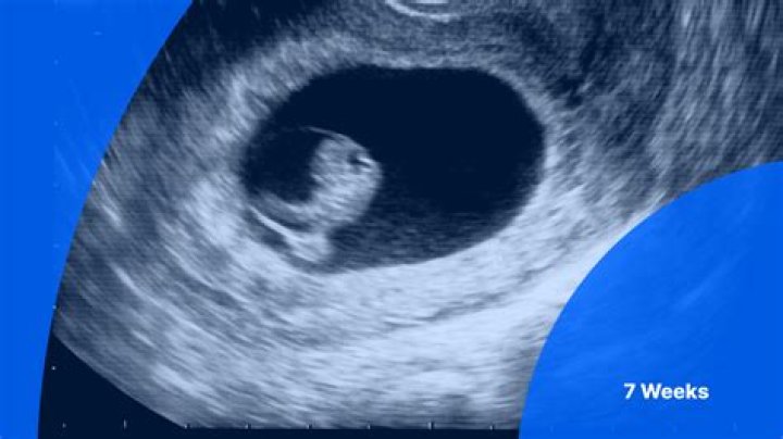 Pregnant Mother of Two Stabbed to Death, Husband Turns Himself In