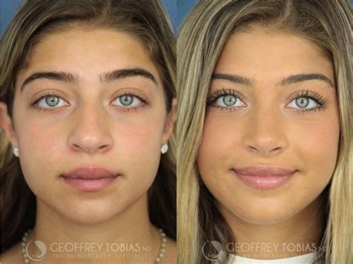 RHONJ fans urge Teresa Giudice’s daughter Gia to stop getting 'plastic surgery' as she looks unrecognizable in new photo