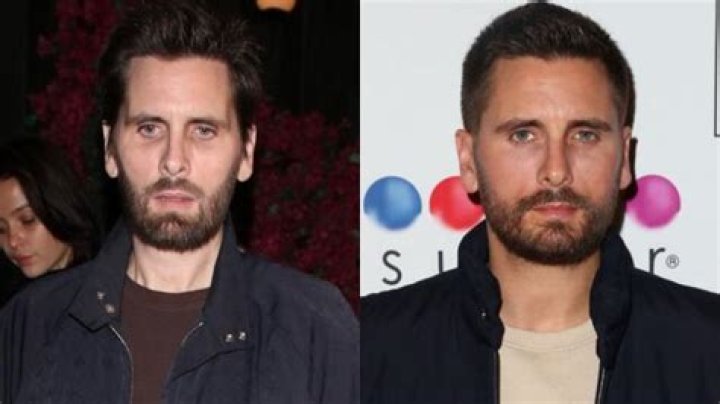Scott Disick faces cruel plastic surgery rumors over his ‘droopy eyebrows’