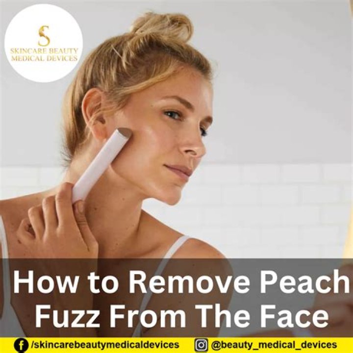 Quick Answer: Should You Remove Peach Fuzz From Face