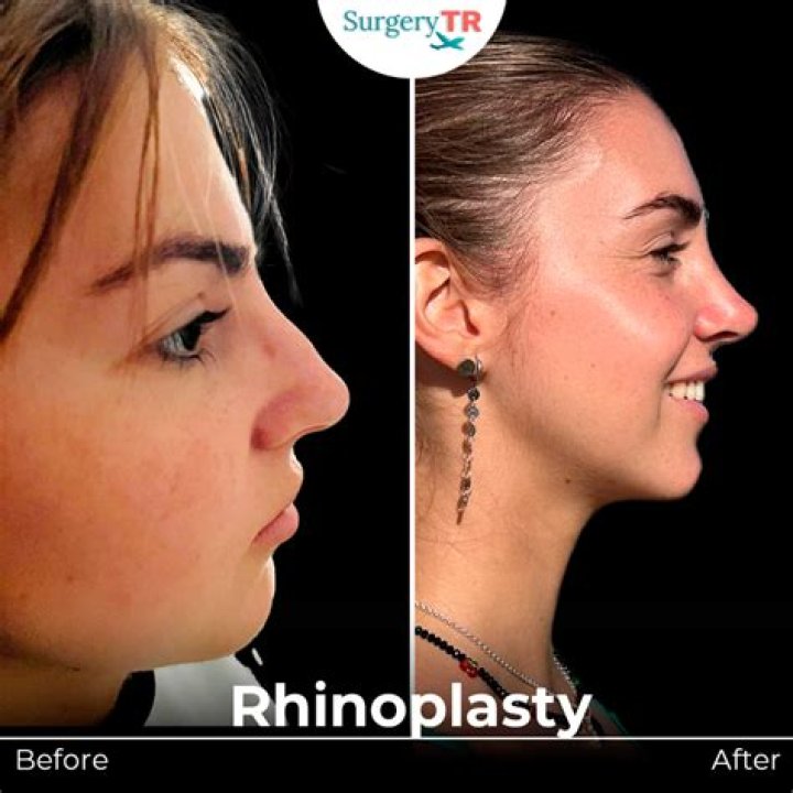 Steven Crowder Plastic Surgery: Separating Fact from Fiction