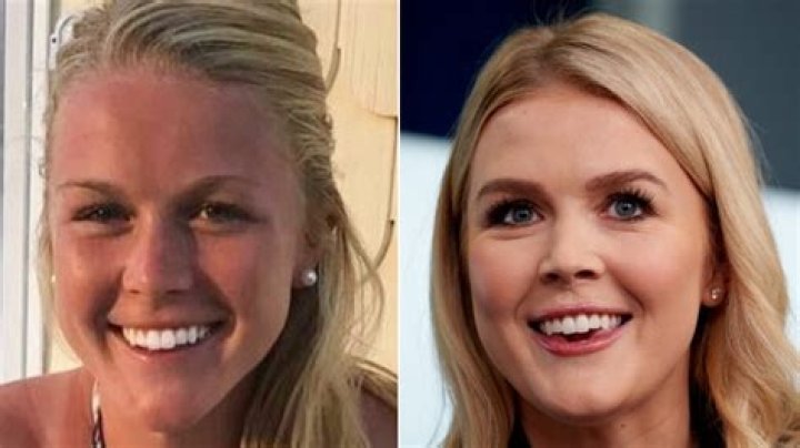 Surgery rumors swirl after The Bachelorette’s Gabby talks ‘fake hair’