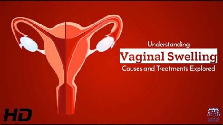 Swollen down there? The 11 things that can cause swelling around your vagina - and when to see your doctor