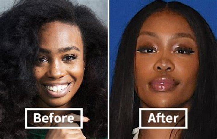 SZA Before and After Plastic Surgery, Transformation Photos