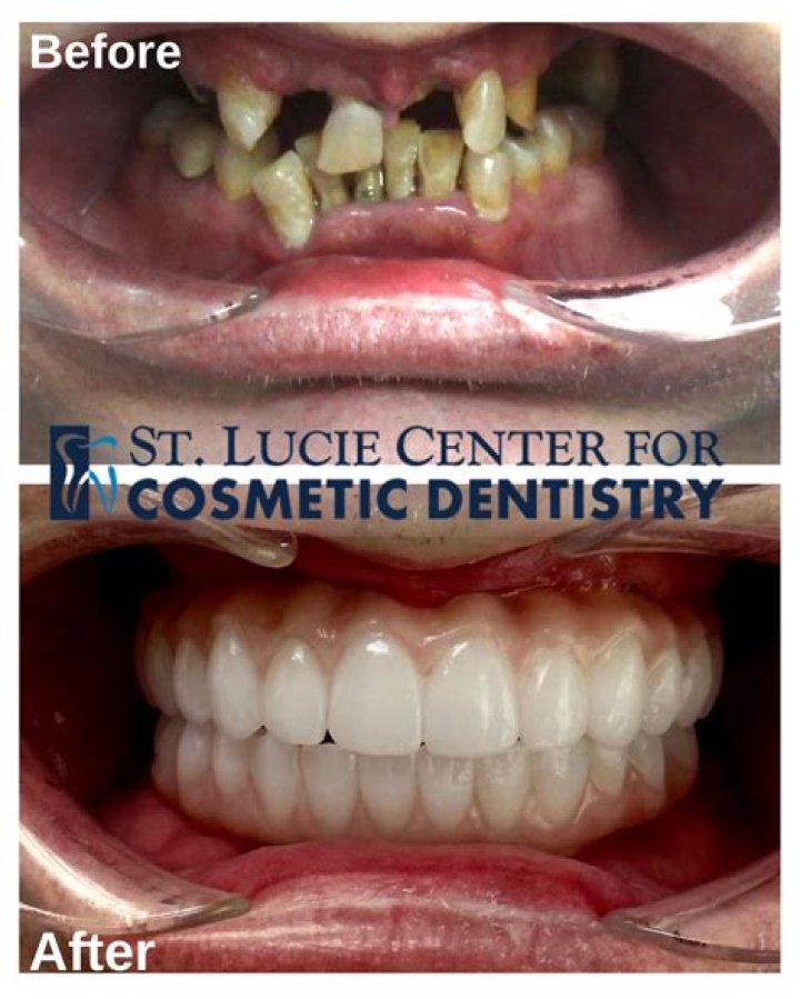 The FACE of PROSTHETIC DENTISTRY