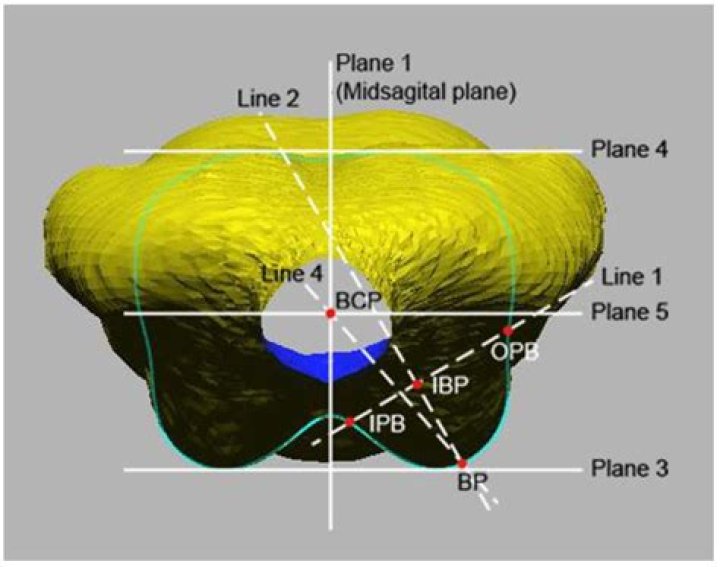 Unveiling The Fascination Of The Three Breast Model