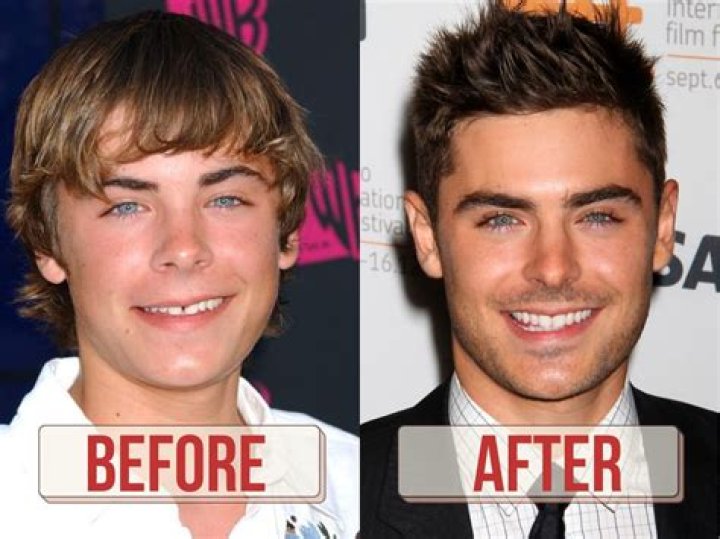 Vanessa Hudgens First Fell in Love With "Gap" in Zac's Teeth