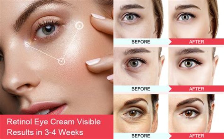 Wealthskin Anti-Aging Eye Cream Claims Results in 2 Minutes