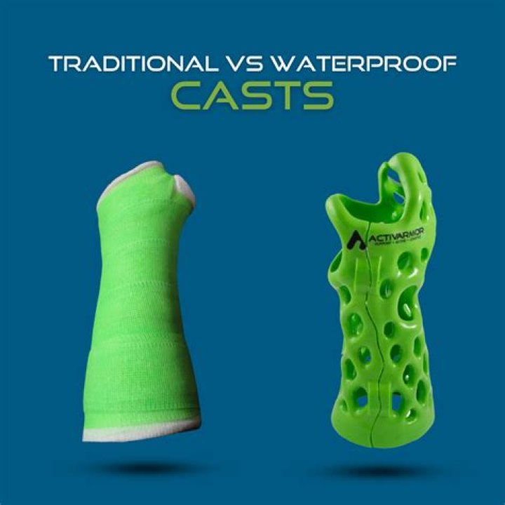 Question: What Colors Of Casts Can You Get