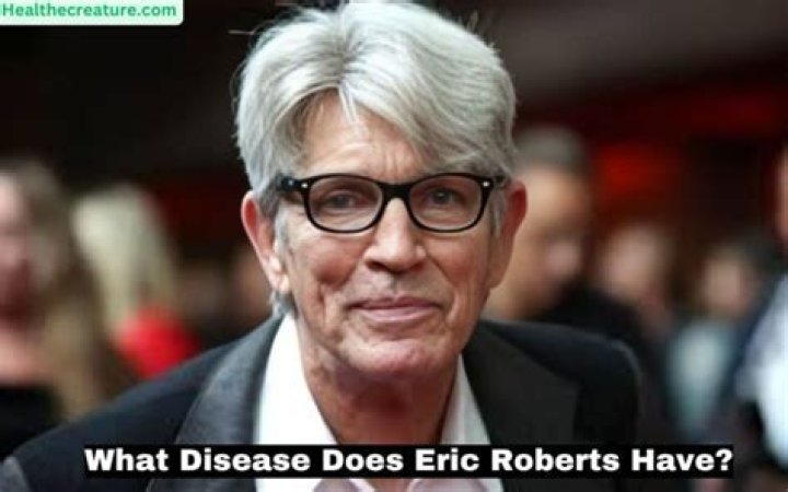 What Disease Does Eric Roberts Have? Understanding His Health Journey