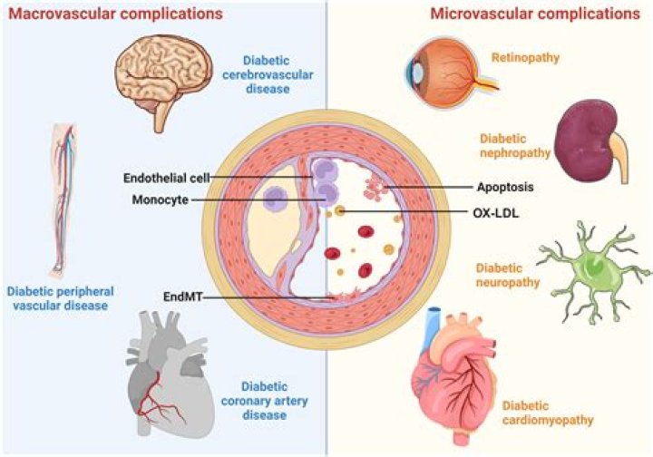 What is Maycomb’s usual disease in Chapter 9?