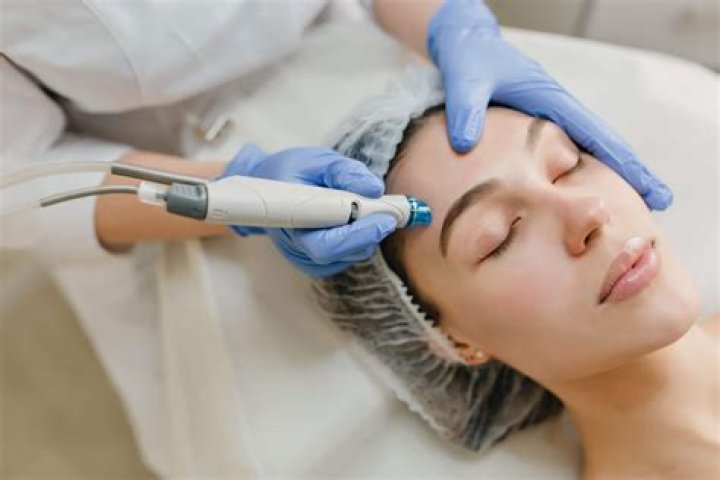 Mesotherapy: What Is It, Benefits And Review