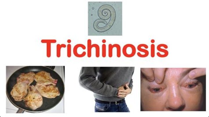 Quick Answer: What Temp Kills Trichinosis