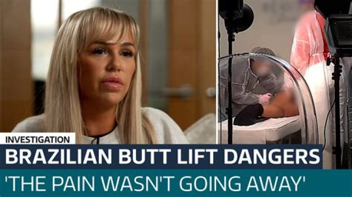 Woman, 26, left with gaping wounds after Brazilian butt lift goes horribly wrong – The US Sun