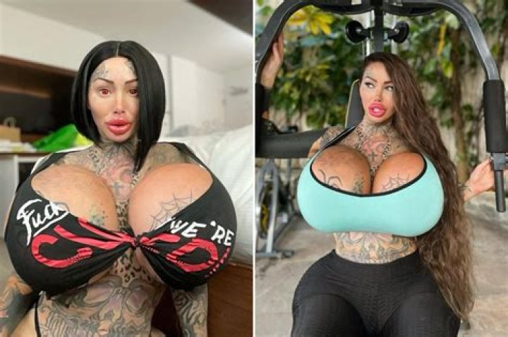 I was the world's most surgically enhanced woman until one of my 38J boobs exploded - now I’m unrecognisable