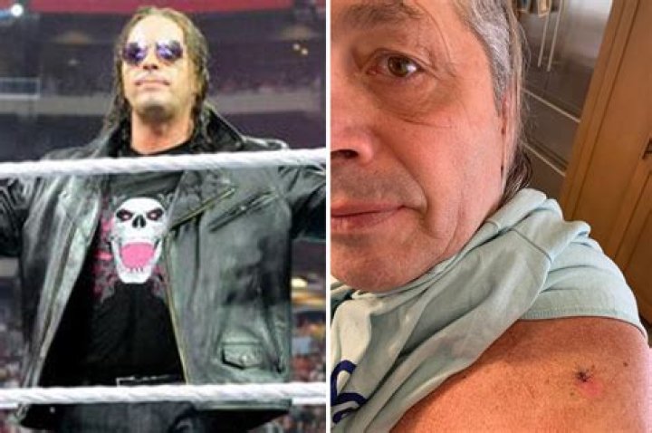 WWE legend Bret ‘The Hitman’ Hart reveals skin cancer diagnosis at 62 and urges fans to get checked out – The US Sun